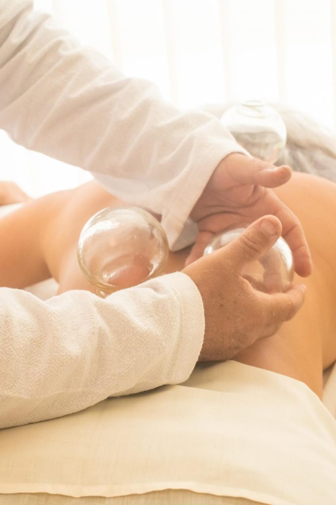 cuppinig therapy session with an expert